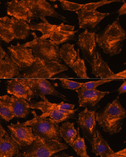 Anti-ITSN2 Antibody (CAB16525)