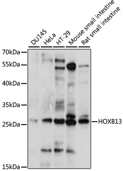 Anti-HOXB13 Antibody (CAB15779)