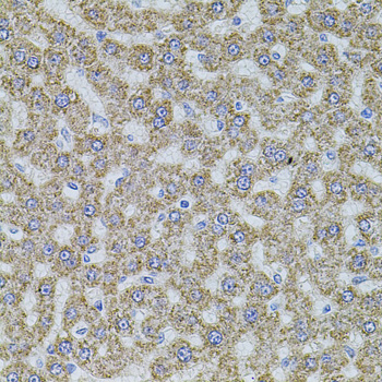 Anti-ALDH1A1 Antibody (CAB1802)