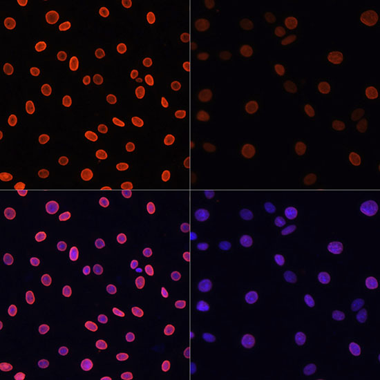 Anti-Acetyl-Histone H4-K91 Antibody (CAB7409)