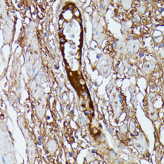 Anti-SAA4 Antibody (CAB16428)