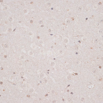 Anti-KDM3A Antibody (CAB11960)
