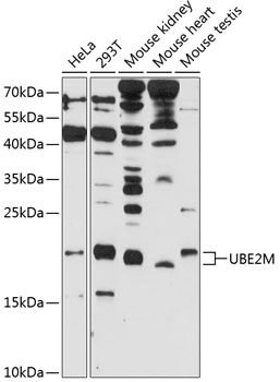 Anti-UBE2M Polyclonal Antibody (CAB9007)