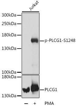 Anti-Phospho-PLCG1-S1248 pAb (CABP0827)