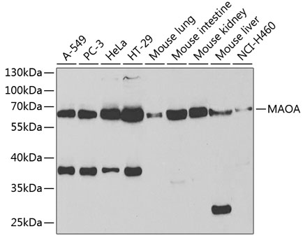 Anti-MAOA Antibody (CAB1354)