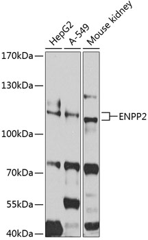 Anti-ENPP2 Antibody (CAB2522)