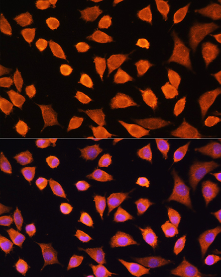 Anti-IL-17A Antibody (CAB0688)