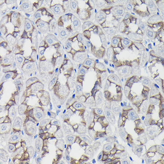 Anti-Beta-Catenin Antibody [KO Validated] (CAB11512)