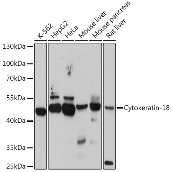 Anti-Cytokeratin-18 Antibody (CAB1022)