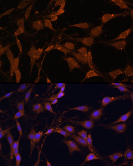 Anti-Bcl-2 Antibody (CAB16776)