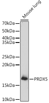 Anti-PRDX5 Antibody (CAB6329)