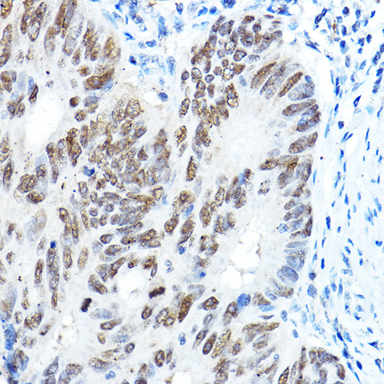 Anti-FOXA1 Antibody (CAB15278)