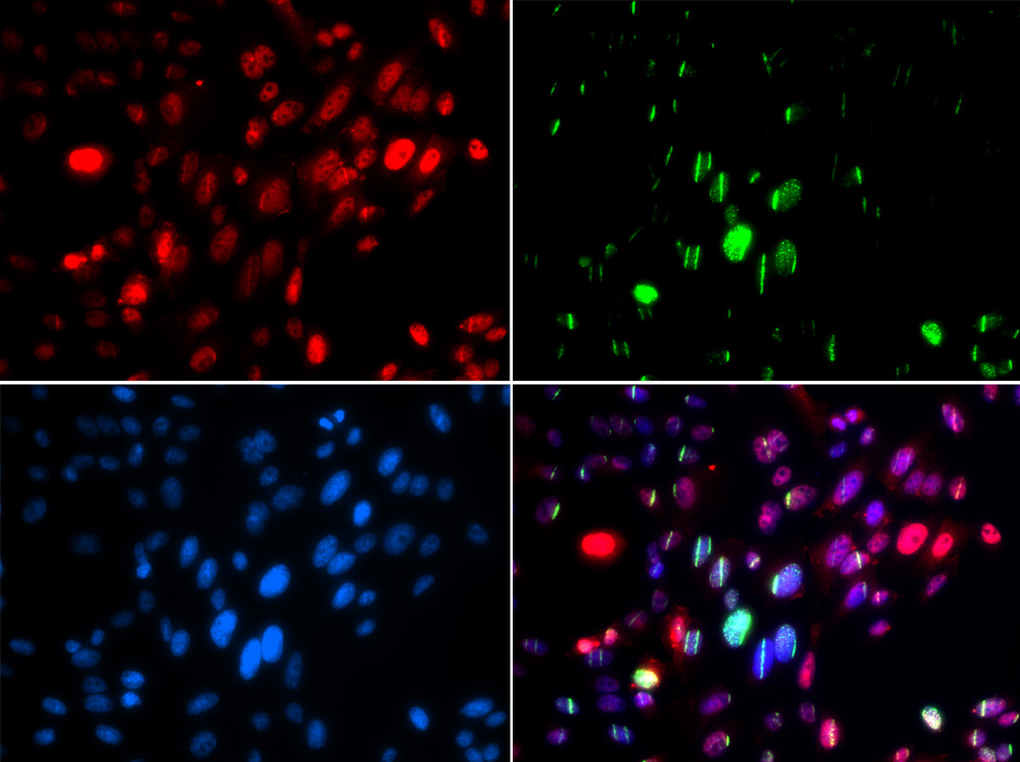 Anti-Phospho-ABL1-Y204 Antibody (CABP0003)