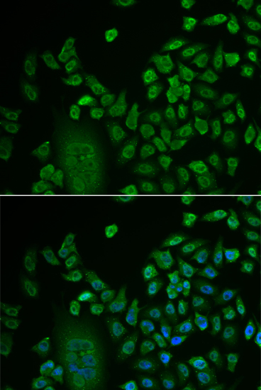 Anti-LSM4 Antibody (CAB13588)