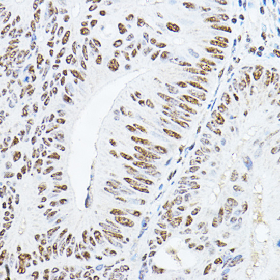 Anti-YEATS4 Antibody (CAB6318)