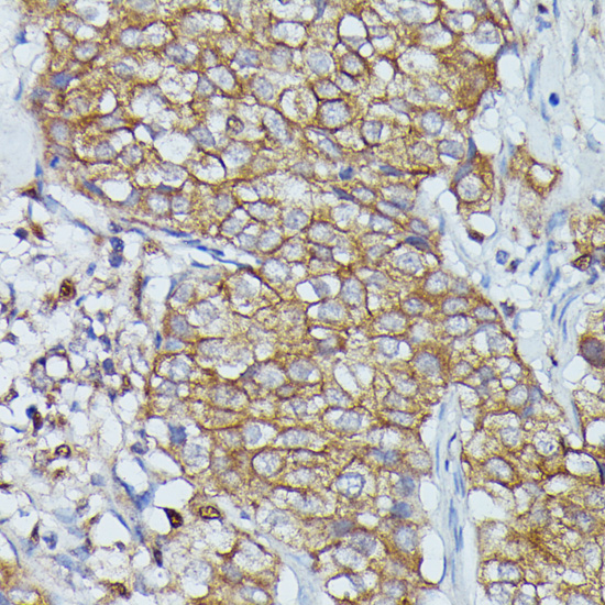 Anti-CTTN Antibody (CAB15054)