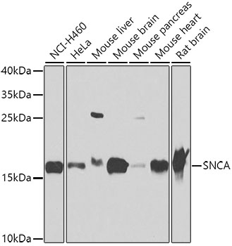 Anti-SNCA Antibody (CAB7215)