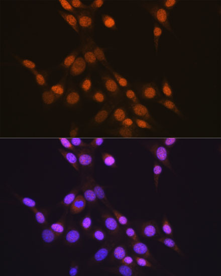 Anti-CTCF Antibody [KO Validated] (CAB19588)