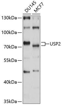 Anti-USP2 Antibody (CAB10399)