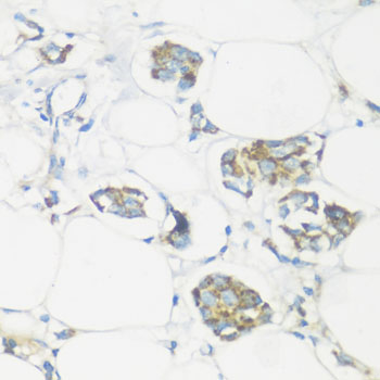 Anti-NMT1 Polyclonal Antibody (CAB8724)