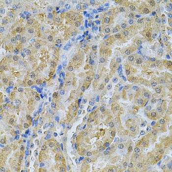 Anti-SERPINA6 Antibody (CAB13609)