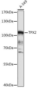 Anti-TPX2 Antibody (CAB18327)