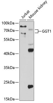 Anti-GGT1 Antibody (CAB1776)