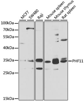 Anti-PHF11 Antibody (CAB7803)