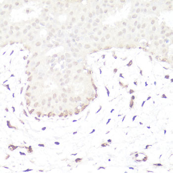 Anti-GLI1 Antibody (CAB14675)