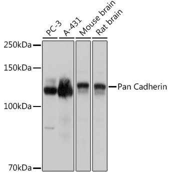 Anti-Pan Cadherin Antibody (CAB18682)