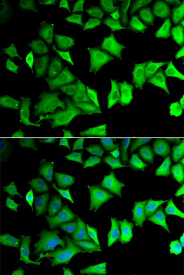 Anti-RPS12 Antibody (CAB5890)