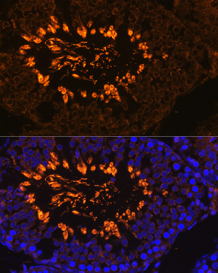 Anti-AKAP4 Antibody (CAB14813)