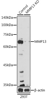 Anti-MMP13 Antibody [KO Validated] (CAB16920)