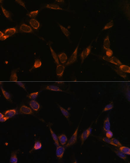 Anti-USP30 Antibody (CAB12862)