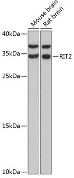 Anti-RIT2 Antibody (CAB13043)