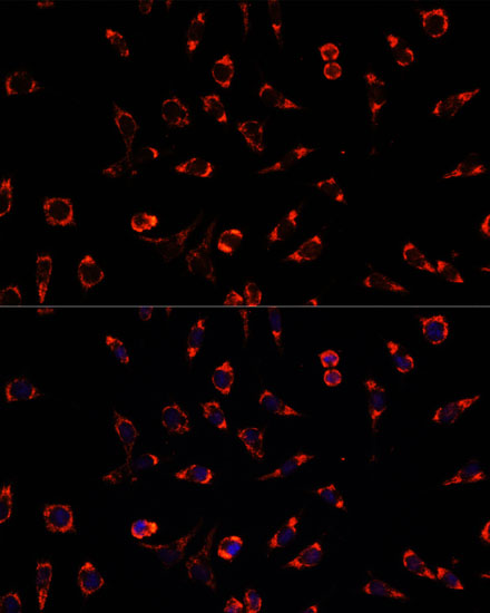 Anti-PAH Antibody (CAB1559)