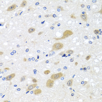 Anti-LCAT Antibody (CAB3942)