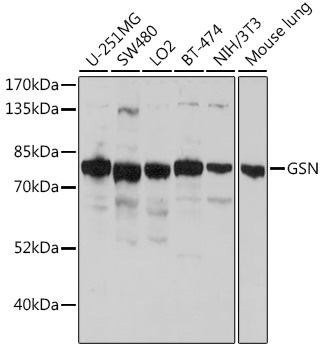 Anti-GSN Antibody (CAB16869)