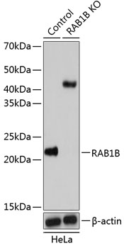 Anti-RAB1B Antibody [KO Validated] (CAB19935)