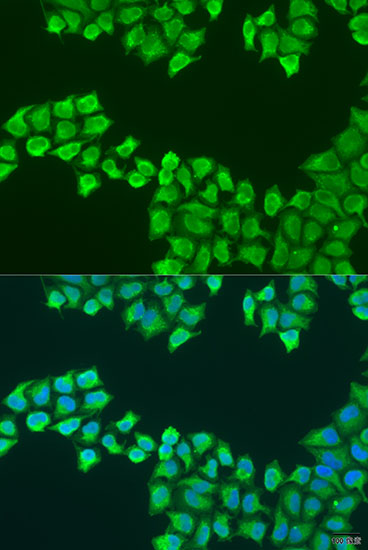 Anti-ATP5F1 Antibody (CAB7645)