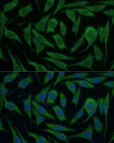 Anti-KIF14 Antibody (CAB10275)