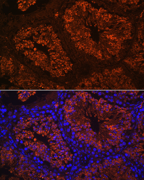 Anti-LHCGR Antibody (CAB6266)