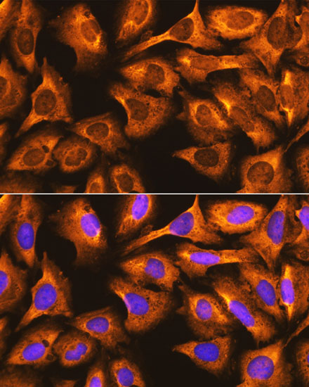 Anti-RPS3 Antibody (CAB13543)