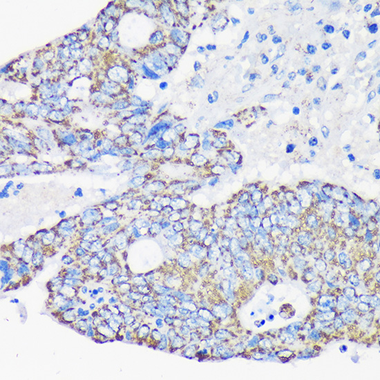 Anti-ACAA2 Antibody (CAB15778)