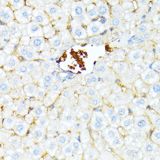 Anti-SPTA1 Antibody (CAB12355)