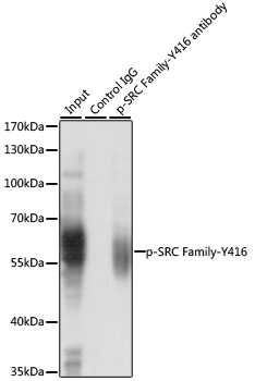 Anti-Phospho-Lck-Y416/FYN-Y416 Antibody (CABP0491)