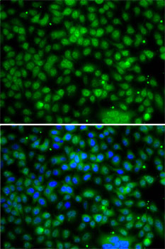 Anti-PHYHD1 Antibody (CAB7208)