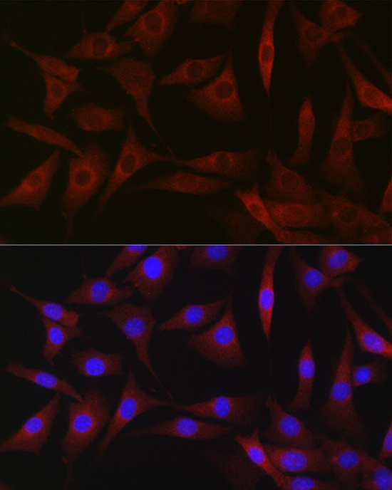 Anti-BDKRB1 Antibody (CAB1959)