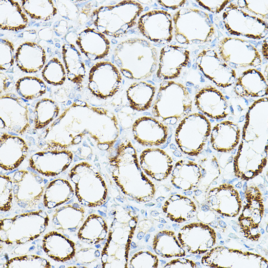 Anti-VEGFB Antibody (CAB12689)