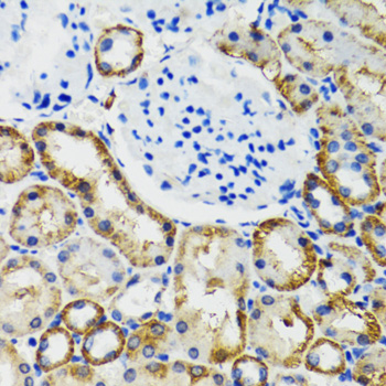 Anti-COMT Antibody (CAB6200)